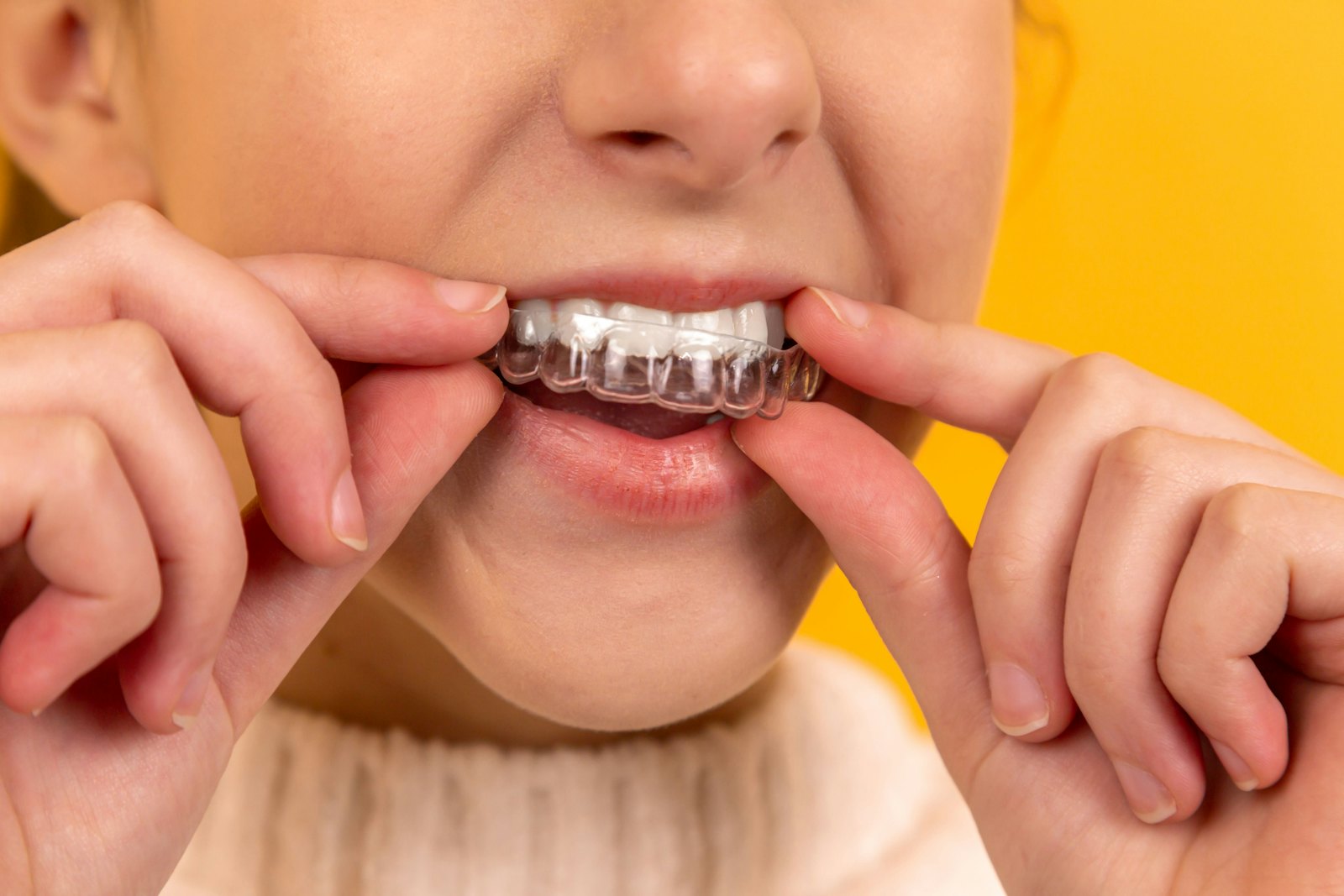Person putting in a clear aligner